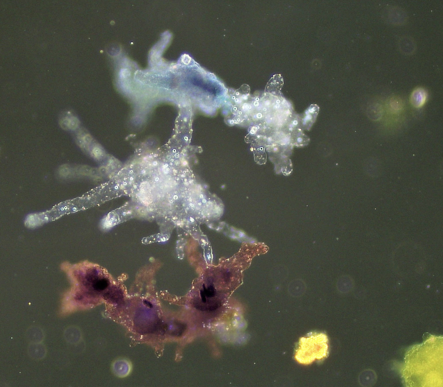 Some day our microbic hearts will conquer the enormous amoebas of the system (Source&nbsp;: Designer IA Microsoft)